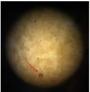 Gambar Lampiran 7. Telur cacing gelang (Ascaris lumbricoides) 
