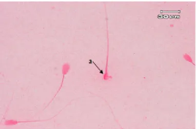 Gambar 1. Microcephalic    spermatozoa  (a)  merupakan  salah  satu  bentuk  morfologi  abnormalitas  primer 