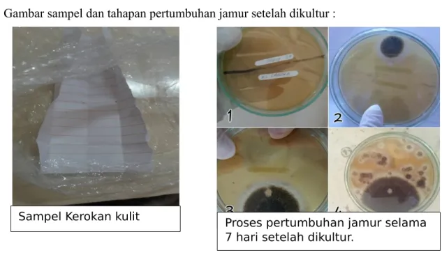 Gambar sampel dan tahapan pertumbuhan jamur setelah dikultur : 