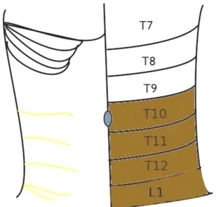 Gambar 2.4 Persarafan kutaneus dinding abdomen. Daerah yang berwarna adalah  daerah yang mengalami efek analgesia pada injeksi tunggal TAP block posterior