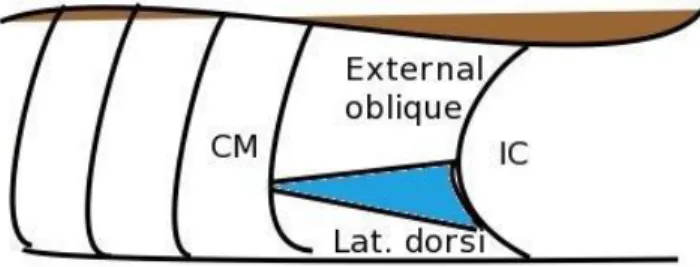 Gambar 2.6 Segitiga petit diantara muskulus obliqus ekternus dan latissimus dorsi  CM: costal margin, IC: krista illiaca