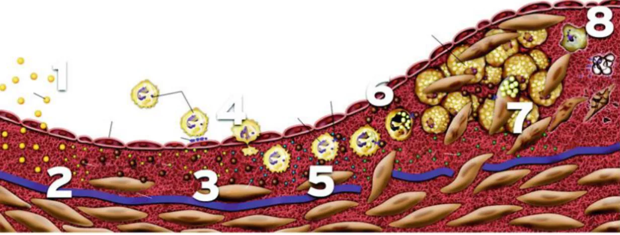 Gambar  2.1.  Tahapan  Perkembangan  Plak  aterosklerosis.  (1)  LDL  diambil  oleh  endotel  (2)  OKsidasi  LDL  oleh  makrofag  dan