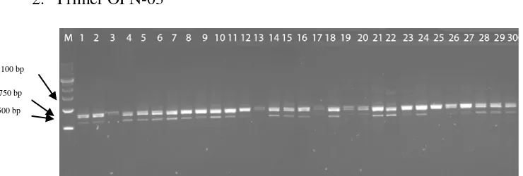 Gambar 4. Hasil pola pita DNA sampel dengan primer OPD-20 