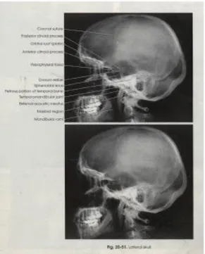 Gambar 2.10 Foto Polos Cranial Posisi Lateral 7 