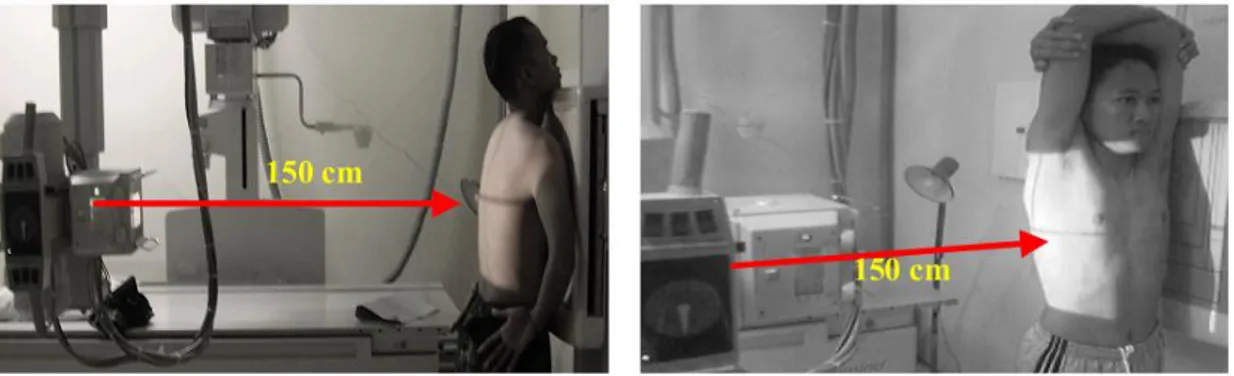 Gambar 2.17 Posisi pemeriksaan foto thorax posisi PA dan Lateral 2