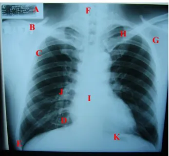 Gambar 2.19 Thorax Posisi PA 
