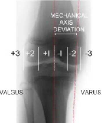 Gambar 2.4 Jika lutut dibagi menjadi kuadran, dan variasi normal yang diperbolehkan untuk, sumbu mekanik harus netral atau setidaknya masuk dalam medial atau lateral zona 1