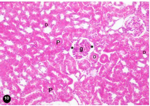 Gambar 2.9  Kortek ginjal normal (g) glomerulus yang dikelilingi    oleh kapsul bowman (D) tubulus distal (P) tubulus proksimal (Abbas, et al., 2012) 