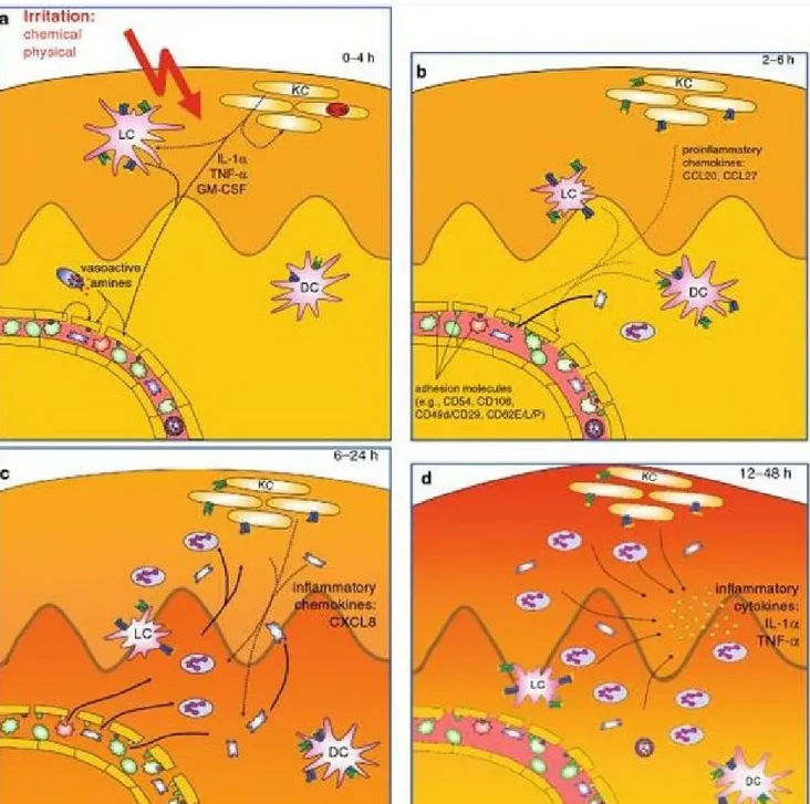 Gambar 1 : (a-d) mekanisme imunologis terjadinya dermatitis kontak iritan (DKI). (a) bahan iritan fisik dan kimia memicu pelepasan sitokin dan mediator inflamasi lainnya yang disebut sinyal bahaya