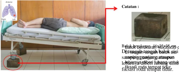 Gambar 6. Posisi drainase postural segmen superior dan inferior  lingula; berbaring   terlentang,  ¼  memutar  ke  arah  kanan,  kaki  ujung  bawah  tempat  tidur  dinaikkan 36 cm  