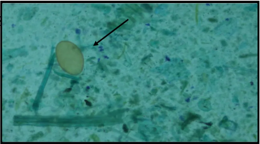 Gambar 4. Hasil pemeriksaan feses dengan metode sedimentasi (Panah: Telur Fasciola sp.)