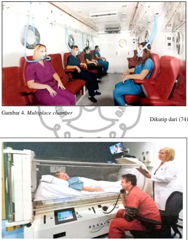 Gambar 4. Multiplace chamber 