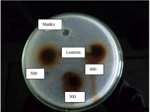 Gambar 3. Hasil Uji Aktivitas Antibakteri Ekstrak Etanol Daun Kecapi Terhadap Bakteri Staphylococcus epidermidis pada Konsentrasi 500mg/ml; 400mg/ml;300mg/ml dan blanko