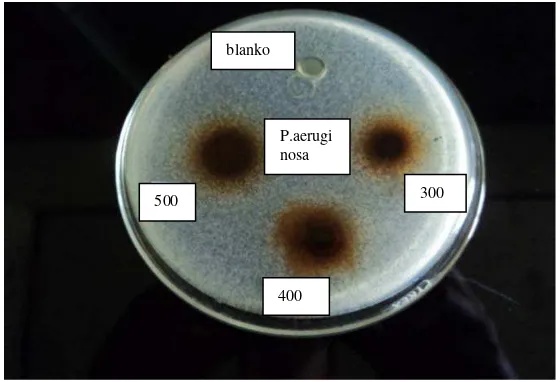 Gambar 5. Hasil Uji Aktivitas Antibakteri Ekstrak Etanol Daun Kecapi Terhadap Bakteri Staphylococcus aureus pada Konsentrasi 200mg/ml; 100mg/ml; 90mg/ml dan 80mg/ml 