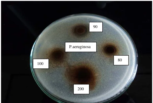 Gambar 6. Hasil Uji Aktivitas Antibakteri Ekstrak Etanol Daun Kecapi Terhadap Bakteri Staphylococcus epidermidis pada Konsentrasi 200mg/ml; 100mg/ml;90mg/ml dan 80mg/ml 