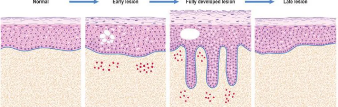 Gambar 2.3. Kondisi inflamasi pada kulit dapat mempunyai variasi faktor presipitasi yang                       besar  (Moyes dan Blessing, 2019) 