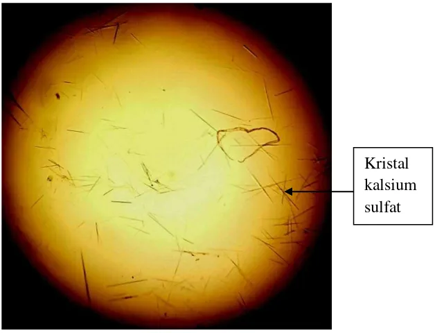 Gambar 8. Kristal Kalium Pikrat (Perbesaran 10 x 10) 