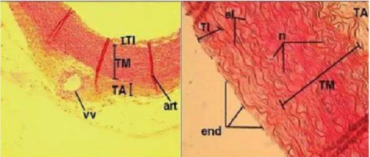 Gambar 2. 9istologi Aorta.