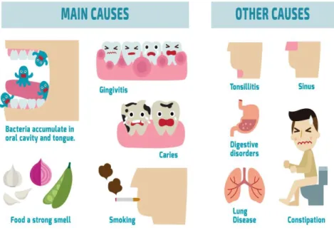 Gambar : Sebab-sebab Bau Mulut (pada umumnya)  Sumber : https://www.ebdg.com.au 