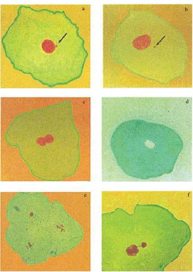 Gambar 1. Abnormalitas inti sel: mikronukleus (a,b); binucleated cell (c);  karyolysis (d); karyorrhexis (e) dan broken egg (f)