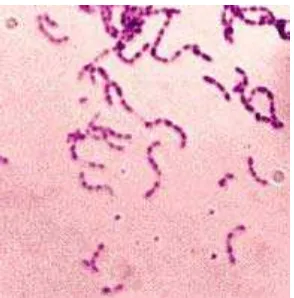 Gambar 2.6. Streptococcus mutans pada Pewarnaan Gram 
