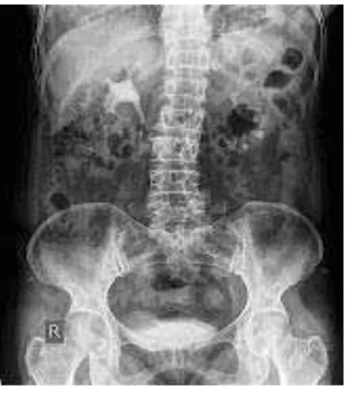 Gambar 2.8.  Foto menit ke-30 Sumber : Radiologi Diagnostik FK UI 