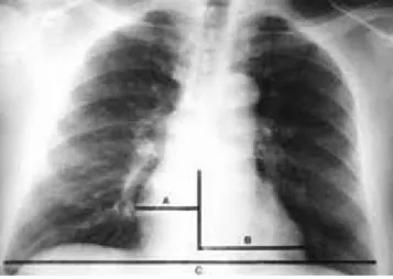Foto Thorax