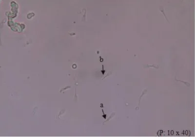 Gambar 4.2. Membran plasma (a) utuh dan (b) tidak utuh  