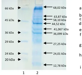 Gambar 1.  Hasil  elektroforesis  OMP  H.pylori  dengan metode SDS-PAGE.  