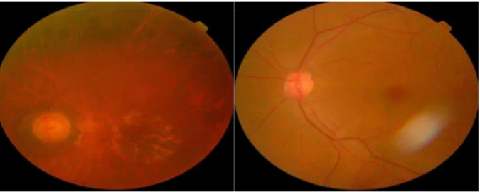 Gambar 2.6: Gambaran retina yang membingungkan. Gambar pertama berisi 