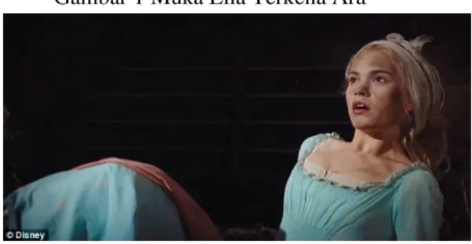 Gambar 1 Muka Ella Terkena Ara 