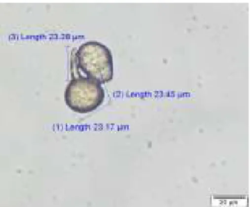 Gambar 2. Urediospora Phakopsora pachyrizi  Pengaruh  ekstrak  bahan  nabati 