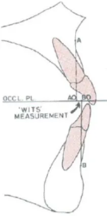 Gambar 1.  Titik AO dan BO yang dihasilkan dari garis tegak lurus titik A dan B  ke dataran oklusal