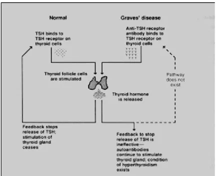 Gambar 1 : Patogenesis Penyakit Graves