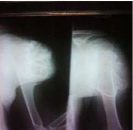 Gambar Radiologis