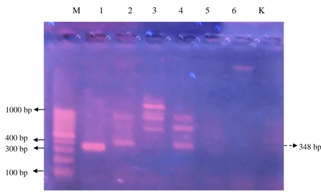 Gambar 2.  Deteksi gen stx-1 dengan primer LP30 dan LP 31 pada agarose 1 %. Lajur 1 kontrol  positif:  ATCC 43894; lajur 2:  isolat FSKS 5 Pecatu; lajur 3:  isolat FSKS 17 Kutuh; 