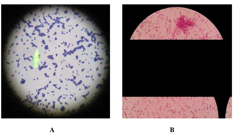 Gambar 4.2 Koloni bakteri (A: Staphylococcus aureus, B: Escherichia coli) 