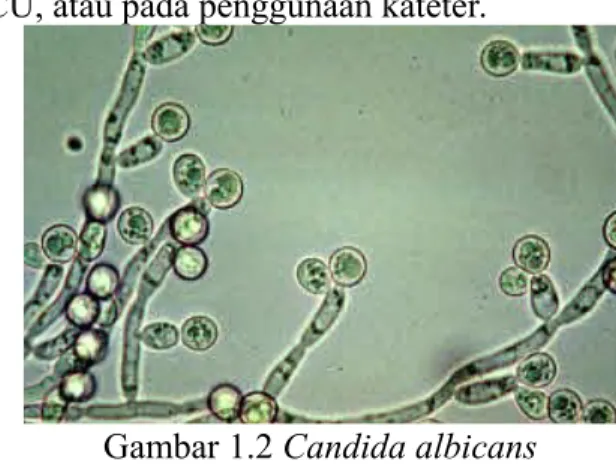 Gambar 1.3 Aspergillus fumigatus 1.2.4 Cryptococcus