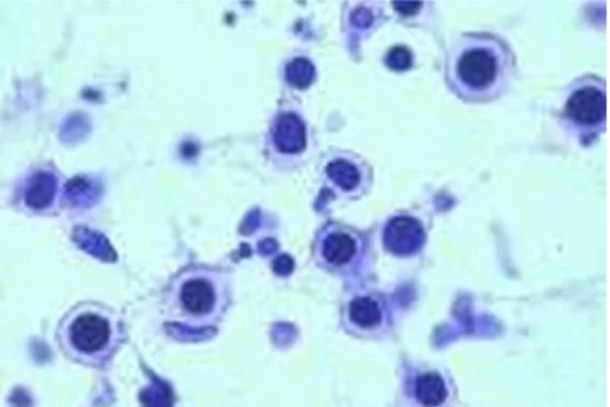 Gambar 1.4 Cryptococcus neoformans 1.3 Patogenesis