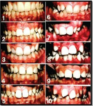Gambar 9. Foto Aesthetic Component 32