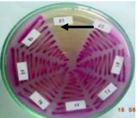Gambar 1. Koloni E. coli O157 (→) pada media   sorbitol macConkey agar (SMAC) 