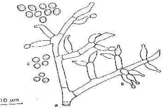 Gambar 5. Trichoderma harzianum. a. Konidiofor. b. Sel-sel pembentuk konidia.c. Konidia (Sumber : Gandjar, dkk, 1999).
