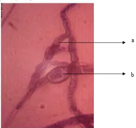 Gambar 1. Bentuk Klamidospora pada jamur Pythium spp.a : Miselium ; b : KlamidosporaSumber : Foto Langsung