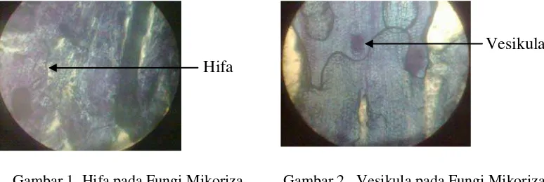 Gambar 1. Hifa pada Fungi Mikoriza 