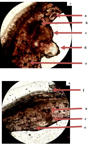 Gambar 10. (A) dan (B) irisan membujur akar terserang nematoda. (a). lubang disebabkan oleh nematoda pada jangan kortek, (b)