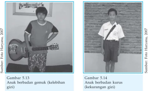 Gambar 5.14 Anak berbadan kurus (kekurangan gizi)