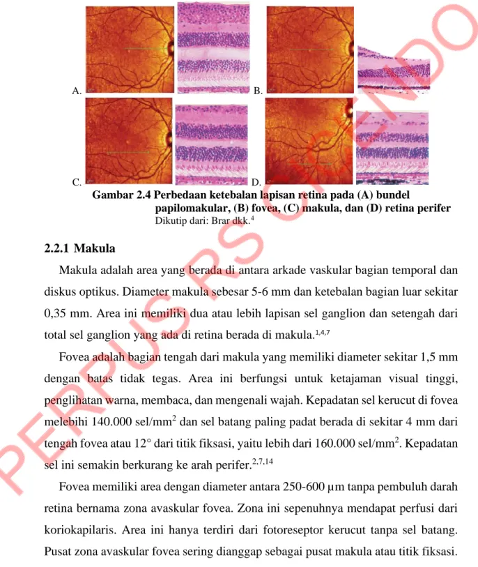 Gambar 2.4 Perbedaan ketebalan lapisan retina pada (A) bundel  