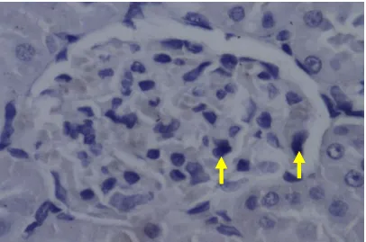 Gambar 4. Gambaran mikroskopis reseptor AGE di glomerolus ginjal tikus kelompok  perlakuan (STZ+latihan fisik) dengan pembesaran 400X (tanda panah menandai sel 