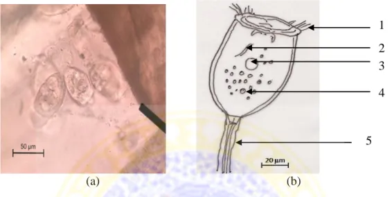Gambar  5.1:  Ektoparasit  yang  menginfestasi  kepiting  bakau  (Scylla  serrata)  (a)  Zoothamnium sp  (400x),  dan  (b)  Zoothamnium  sp  digambar  menggunakan  mikroskop  dengan kamera lucida (400x)