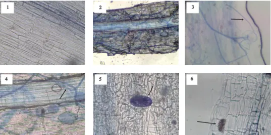 Gambar  1.  Arsitektur  modifikasi  organ  CMA  pada  akar  tanaman,  (1).  akar  yang  tidak  terdapat  kolonisasi,  (2)